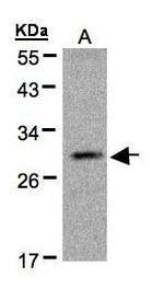 Kallikrein 2 Antibody in Western Blot (WB)