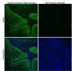 PCNA Antibody in Immunohistochemistry (Paraffin) (IHC (P))