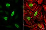 Rb Antibody in Immunocytochemistry (ICC/IF)