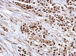 Rb Antibody in Immunohistochemistry (Paraffin) (IHC (P))