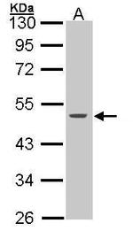 Cytokeratin 15 Antibody in Western Blot (WB)