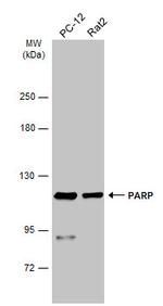 PARP1 Antibody in Western Blot (WB)