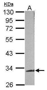 TDP-43 Antibody in Western Blot (WB)