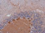 p130Cas Antibody in Immunohistochemistry (Paraffin) (IHC (P))