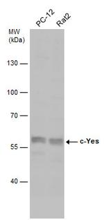 YES1 Antibody in Western Blot (WB)