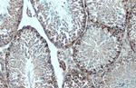 Vimentin Antibody in Immunohistochemistry (Paraffin) (IHC (P))