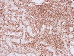 Vimentin Antibody in Immunohistochemistry (Paraffin) (IHC (P))