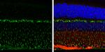 Vimentin Antibody in Immunohistochemistry (Paraffin) (IHC (P))