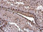 Vimentin Antibody in Immunohistochemistry (Paraffin) (IHC (P))