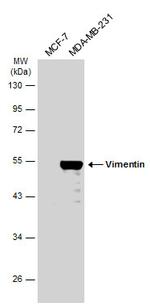 Vimentin Antibody in Western Blot (WB)