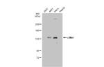 c-Met Antibody in Western Blot (WB)