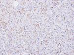 COX2 Antibody in Immunohistochemistry (Paraffin) (IHC (P))