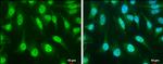 SOCS1 Antibody in Immunocytochemistry (ICC/IF)