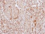 SOCS1 Antibody in Immunohistochemistry (Paraffin) (IHC (P))