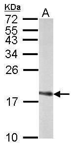 SOD1 Antibody in Western Blot (WB)