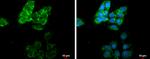 MMP13 Antibody in Immunocytochemistry (ICC/IF)