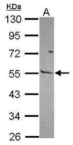 MMP13 Antibody in Western Blot (WB)