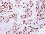 C/EBP beta Antibody in Immunohistochemistry (Paraffin) (IHC (P))