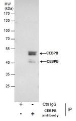 C/EBP beta Antibody in Western Blot (WB)