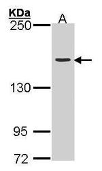 TOP2A Antibody in Western Blot (WB)