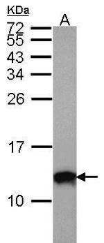 S100A10 Antibody in Western Blot (WB)