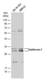 Kallikrein 7 Antibody in Western Blot (WB)