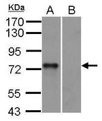 Syk Antibody in Western Blot (WB)