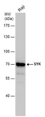 Syk Antibody in Western Blot (WB)