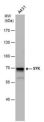 Syk Antibody in Western Blot (WB)