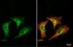 RRM1 Antibody in Immunocytochemistry (ICC/IF)