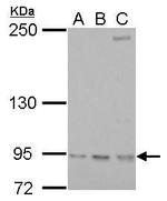 RRM1 Antibody in Western Blot (WB)