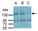 CD51 Antibody in Western Blot (WB)