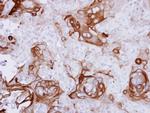 RPSA Antibody in Immunohistochemistry (Paraffin) (IHC (P))