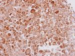 Cytokeratin 16 Antibody in Immunohistochemistry (Paraffin) (IHC (P))