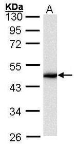 Cytokeratin 16 Antibody in Western Blot (WB)