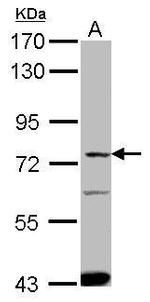 SLC27A4 Antibody in Western Blot (WB)