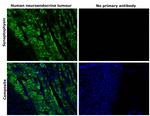 Synaptophysin Antibody in Immunohistochemistry (Paraffin) (IHC (P))