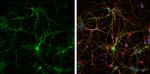 Synaptophysin Antibody in Immunocytochemistry (ICC/IF)