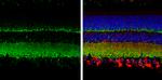 Synaptophysin Antibody in Immunohistochemistry (Paraffin) (IHC (P))