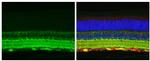 Tau Antibody in Immunohistochemistry (Paraffin) (IHC (P))