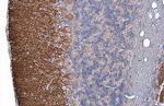 Tau Antibody in Immunohistochemistry (Paraffin) (IHC (P))