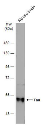 Tau Antibody in Western Blot (WB)