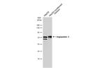 Angiopoietin 2 Antibody in Western Blot (WB)