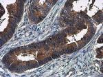 Amphiregulin Antibody in Immunohistochemistry (Paraffin) (IHC (P))