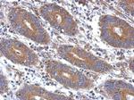 Angiopoietin 2 Antibody in Immunohistochemistry (Paraffin) (IHC (P))