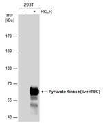 PKLR Antibody in Western Blot (WB)