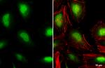 VHL Antibody in Immunocytochemistry (ICC/IF)