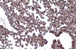 VHL Antibody in Immunohistochemistry (Paraffin) (IHC (P))