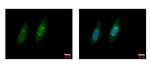 VCP Antibody in Immunocytochemistry (ICC/IF)