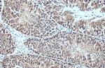 HSC70 Antibody in Immunohistochemistry (Paraffin) (IHC (P))